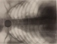 An illustration from The Röntgen rays in medical work (1899)