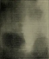 An illustration from The Röntgen rays in medical work (1899)
