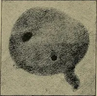An illustration from The Röntgen rays in medical work (1899)