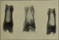 An illustration from The Röntgen rays in medical work (1899)