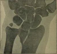 An illustration from The Röntgen rays in medical work (1899)