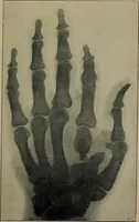 An illustration from The Röntgen rays in medical work (1899)
