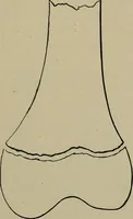 An illustration from The Röntgen rays in medical work (1899)