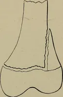 An illustration from The Röntgen rays in medical work (1899)