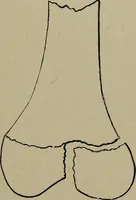 An illustration from The Röntgen rays in medical work (1899)