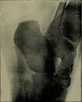 An illustration from The Röntgen rays in medical work (1899)