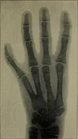 An illustration from The Röntgen rays in medical work (1899)