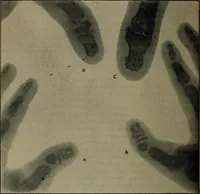 An illustration from The Röntgen rays in medical work (1899)