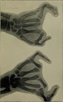 An illustration from The Röntgen rays in medical work (1899)