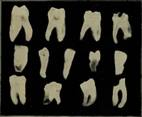 An illustration from The Röntgen rays in medical work (1899)