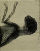An illustration from The Röntgen rays in medical work (1899)