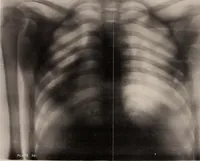 An illustration from The Röntgen rays in medical work (1899)