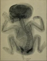 An illustration from The Röntgen rays in medical work (1899)