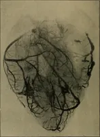 An illustration from The Röntgen rays in medical work (1899)