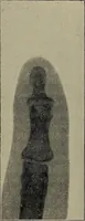 An illustration from The Röntgen rays in medical work (1899)