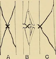 Picture 63 of 147 from The Röntgen rays in medical work (1907), leaf 155