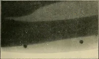 Picture 64 of 147 from The Röntgen rays in medical work (1907), leaf 158