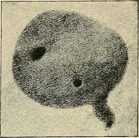 An illustration from The Röntgen rays in medical work (1907)