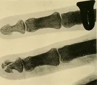 An illustration from The Röntgen rays in medical work (1907)