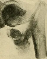 An illustration from The Röntgen rays in medical work (1907)