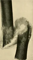 Picture 94 of 147 from The Röntgen rays in medical work (1907), leaf 238
