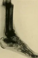 An illustration from The Röntgen rays in medical work (1907)