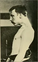 An illustration from The Röntgen rays in medical work (1907)