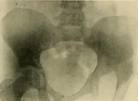 Picture 102 of 147 from The Röntgen rays in medical work (1907), leaf 256