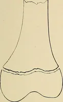 An illustration from The Röntgen rays in medical work (1907)