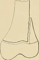 An illustration from The Röntgen rays in medical work (1907)