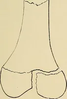 Picture 107 of 147 from The Röntgen rays in medical work (1907), leaf 262