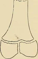 Picture 108 of 147 from The Röntgen rays in medical work (1907), leaf 262