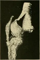 Picture 109 of 147 from The Röntgen rays in medical work (1907), leaf 265