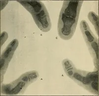 Picture 118 of 147 from The Röntgen rays in medical work (1907), leaf 276