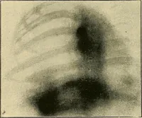 An illustration from The Röntgen rays in medical work (1907)