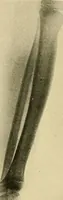 An illustration from The Röntgen rays in medical work (1907)