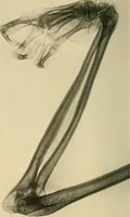 An illustration from The Röntgen rays in medical work (1907)