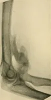 An illustration from The Röntgen rays in medical work (1907)