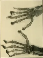 An illustration from The Röntgen rays in medical work (1907)