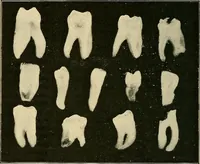Picture 135 of 147 from The Röntgen rays in medical work (1907), leaf 333