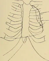 Picture 138 of 147 from The Röntgen rays in medical work (1907), leaf 350