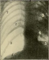 An illustration from The Röntgen rays in medical work (1907)