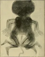 An illustration from The Röntgen rays in medical work (1907)