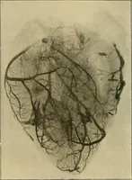 Picture 147 of 147 from The Röntgen rays in medical work (1907), leaf 435