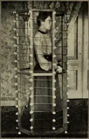 Picture 63 of 72 from Röntgentechniek : therapeutische beteekenis der "X" -stralen en der stoomen van hooge fréquentie (1904), leaf 110