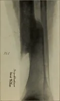 An illustration from Röntgentechniek : therapeutische beteekenis der "X" -stralen en der stoomen van hooge fréquentie (1904)