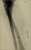 An illustration from Röntgentechniek : therapeutische beteekenis der "X" -stralen en der stoomen van hooge fréquentie (1904)