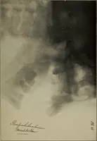 An illustration from Röntgentechniek : therapeutische beteekenis der "X" -stralen en der stoomen van hooge fréquentie (1904)