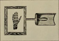 Picture 48 of 72 from Röntgentechniek : therapeutische beteekenis der "X" -stralen en der stoomen van hooge fréquentie (1904), leaf 76