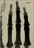 An illustration from Röntgentechniek : therapeutische beteekenis der "X" -stralen en der stoomen van hooge fréquentie (1904)